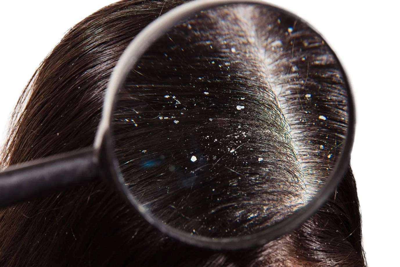 Hair Transplantation