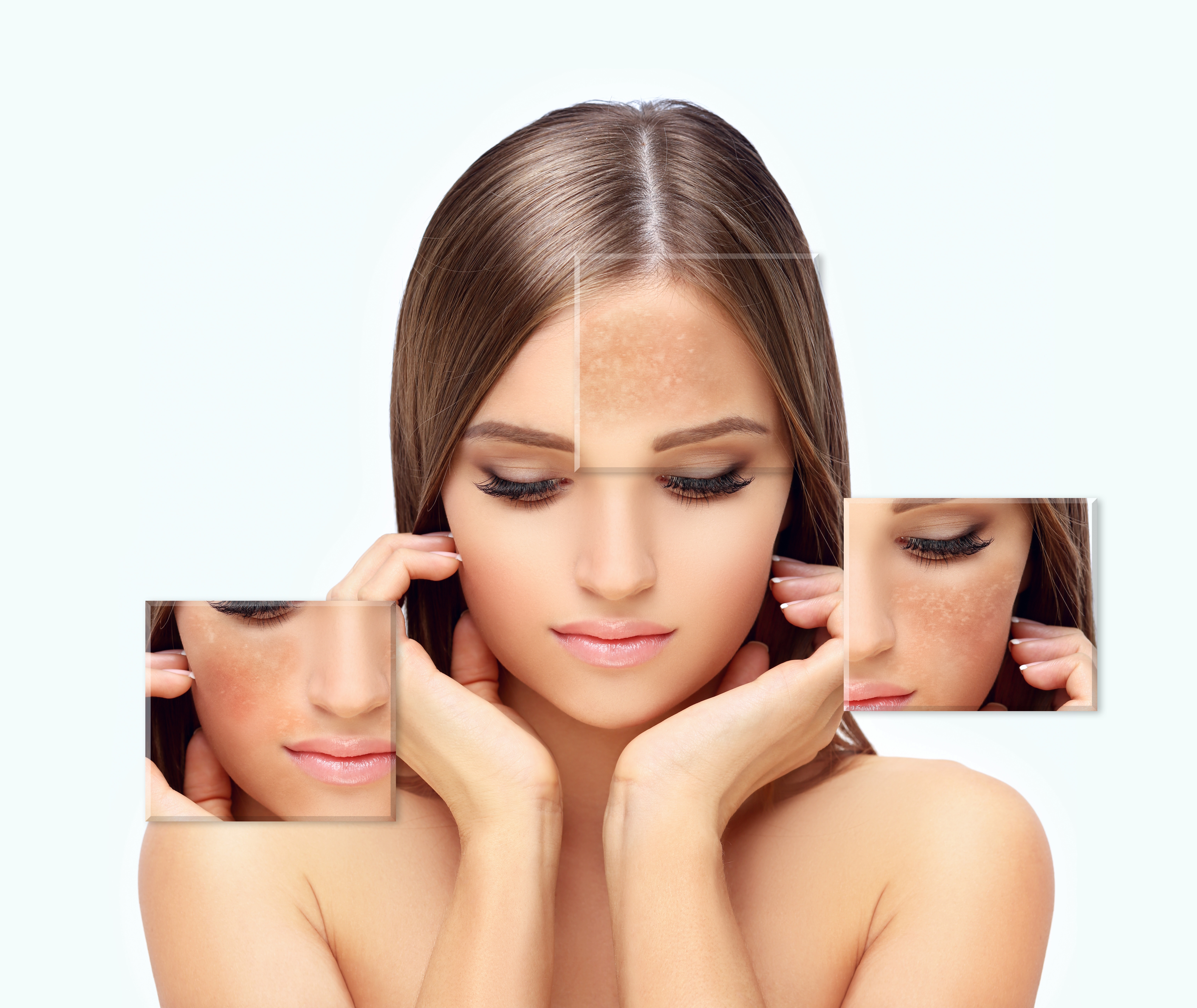 Hair Growth Factor Concentrate Treatment