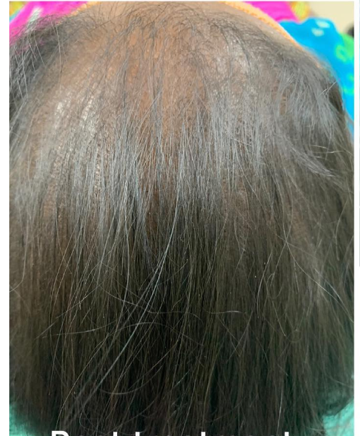 Image after hair treatment