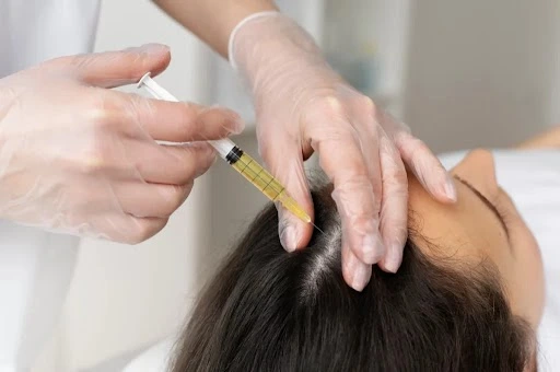 PRP Treatments
