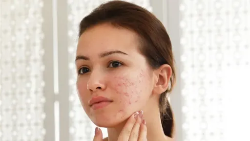 PRP Treatments