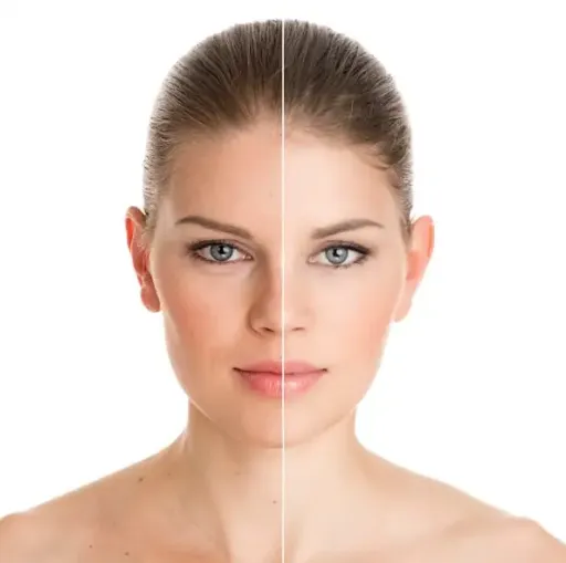 Skin Rejuvenation