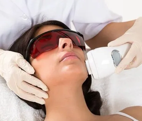 Laser Hair Reduction